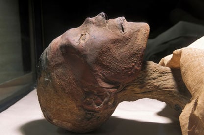 A mummy head