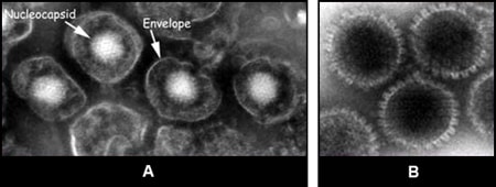 Images of herpesvirus particles from tissue culture