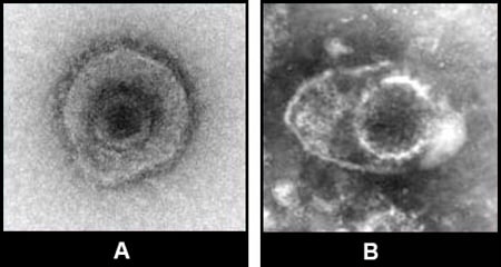 Images of herpesvirus from clinical specimens