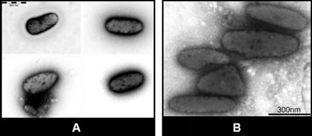 EM images of melanosomes.