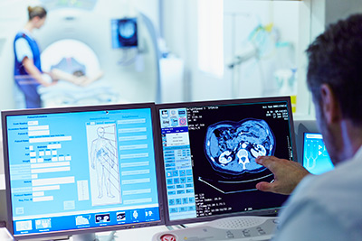 Un médico observa un escáner cerebral en un monitor de computadora. Un médico observa un escáner cerebral en un monitor de computadora.
