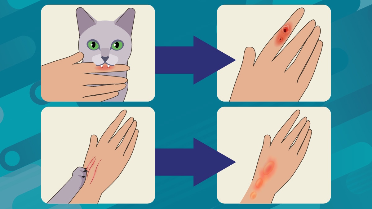 Clinical Overview of Sporotrichosis | Sporotrichosis | CDC