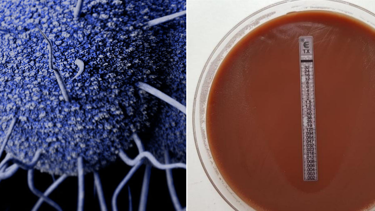 photo of a gradient strip and a visualization of bacteria