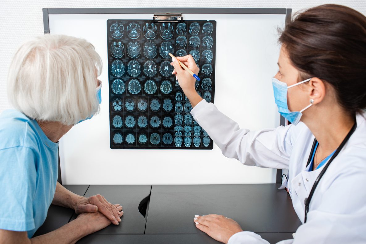 Doctor explains to an elderly woman the results of an MRI scan