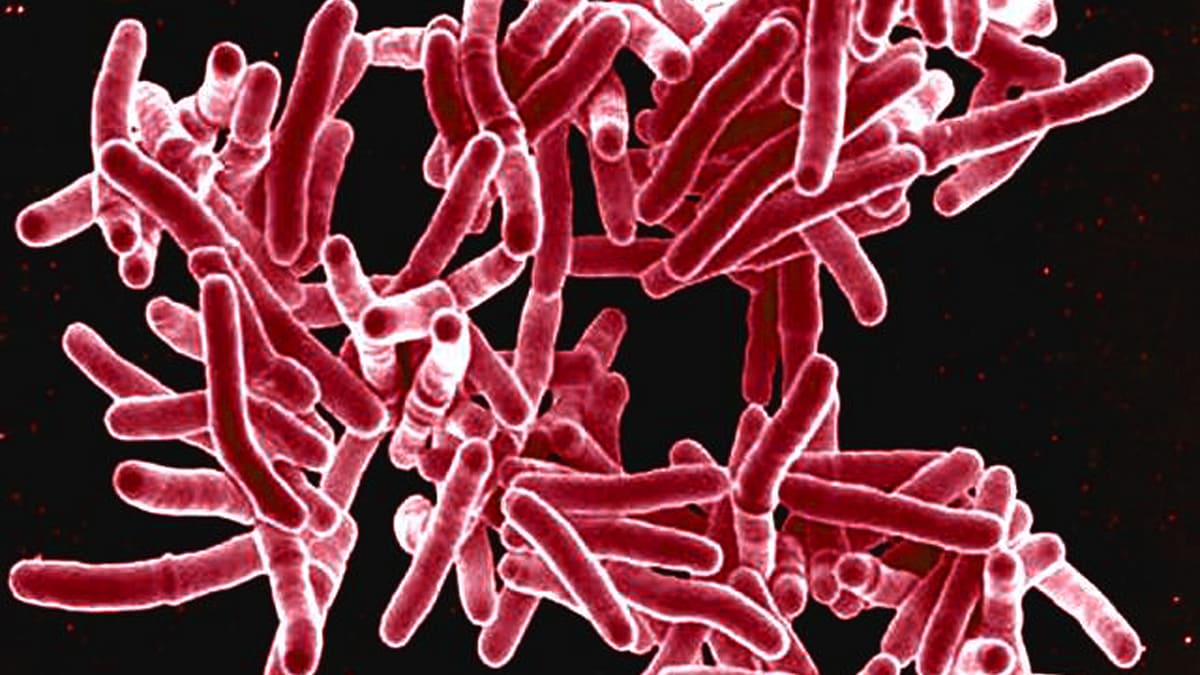 Tuberculosis bacteria shown under a microscope