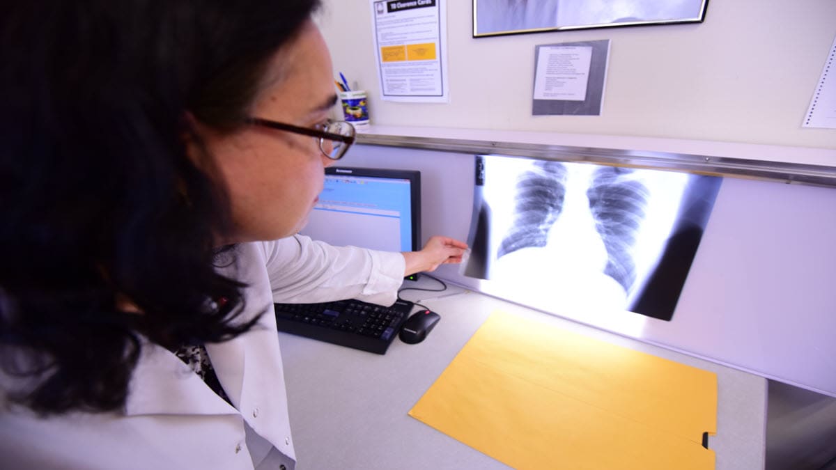 A healthcare provider reviewing X-ray of the lungs.