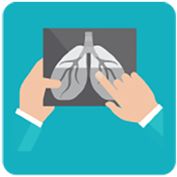 health-effects2a Manos sosteniendo una radiografía