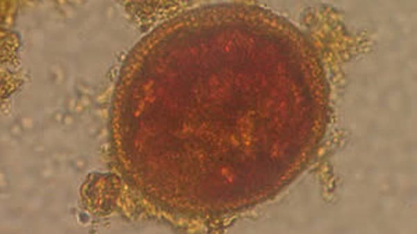 Toxocariasis egg