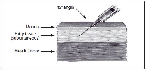 subcutaneous injection needle size