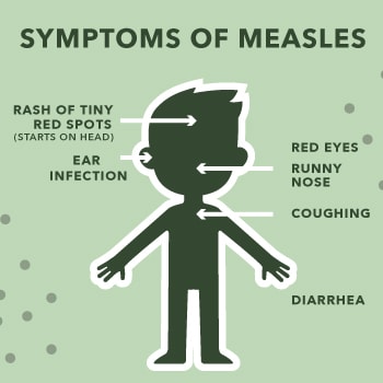 What are the serious side effects of measles vaccine?