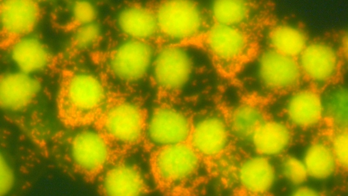 Rickettsia parkeri bacteria in Vero E6 cell culture (acridine orange stain).