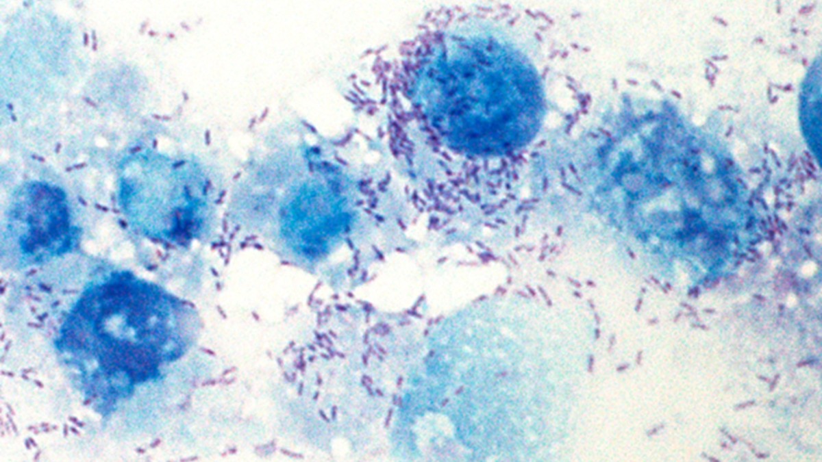 Rickettsia lanei bacteria in Vero E6 cell culture (Giménez stain).