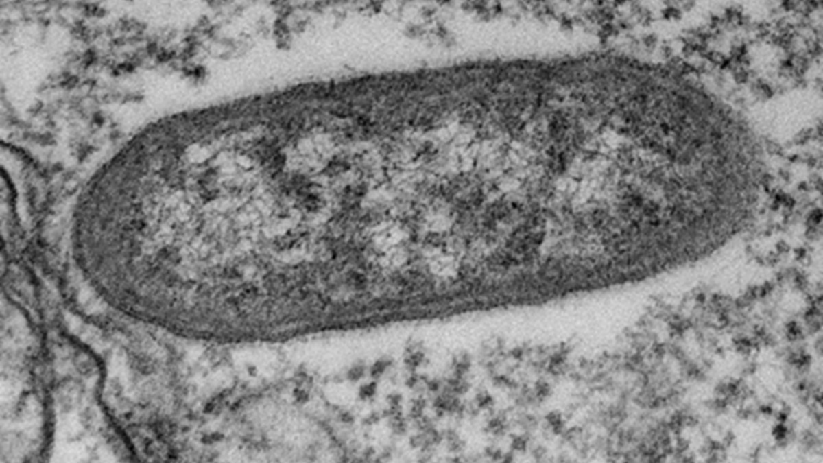 Rickettsia tillamookensis bacterium in cytosol of Vero E6 cell.