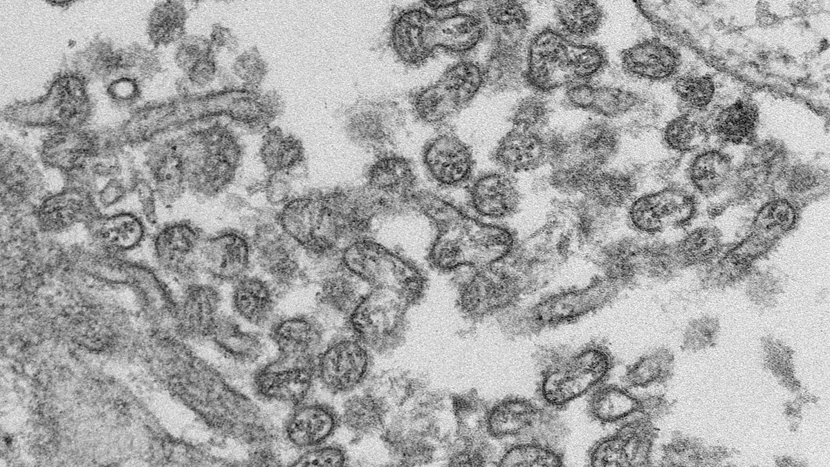 Transmission electron microscopic image of numerous extracellular Bourbon virus particles (PHIL 19480).