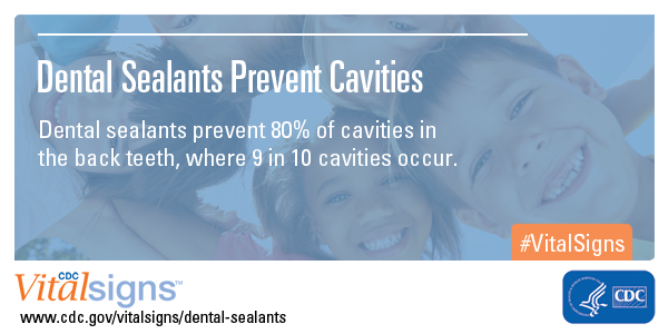 Dental Sealants Prevent Cavities Vital Signs Cdc