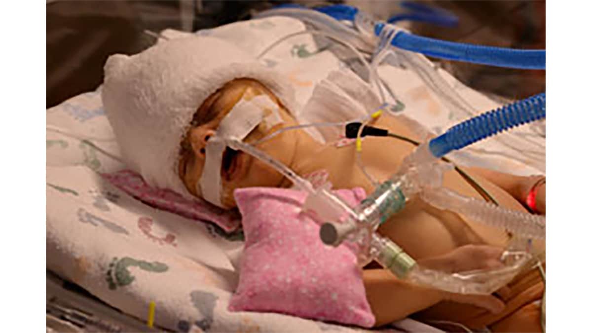 Baby Olive hooked up to machines in the ICU