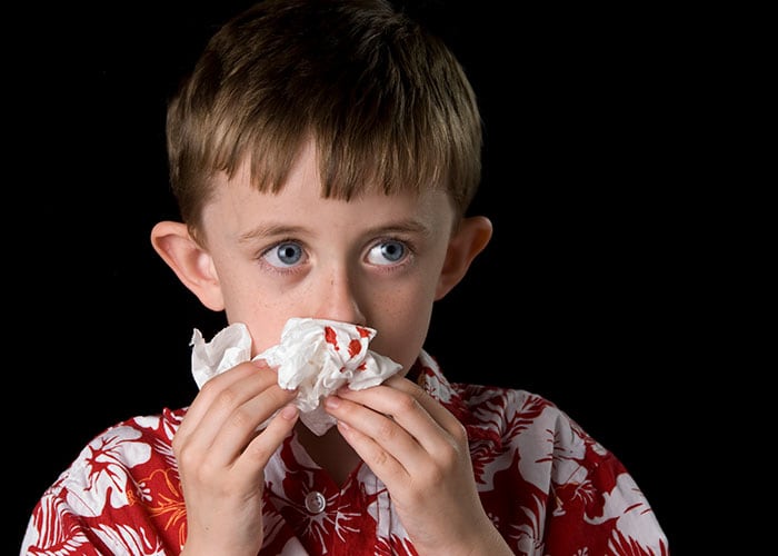 Young boy blotting his nose with a tissue to help stop a nosebleed